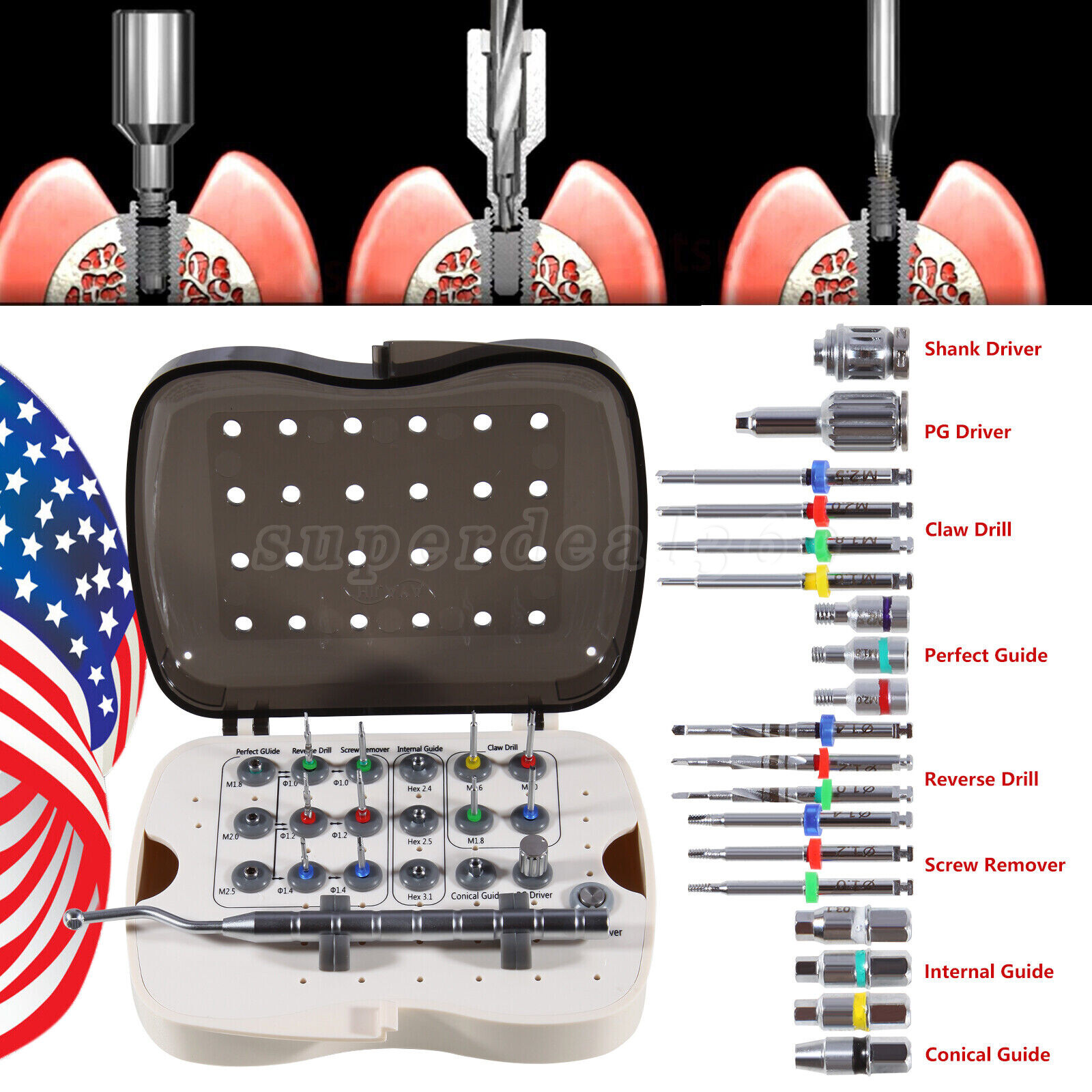 Dental Implant Fixture &Broken Screw Removal Kit Remove Surgical Tool Remover OR