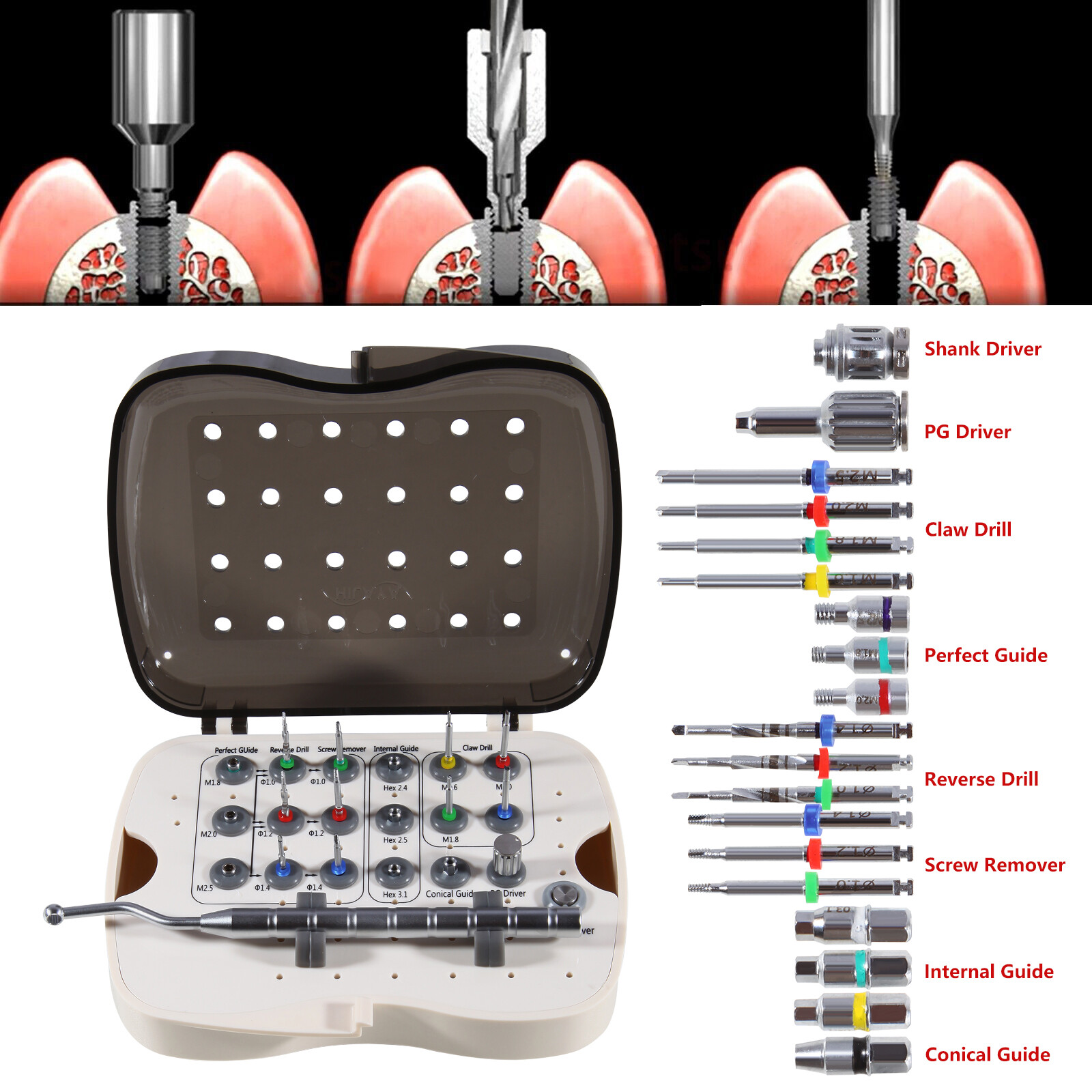 Implant Fixture & Fractured Screw Removal Kit NeoBiotech SR Dental