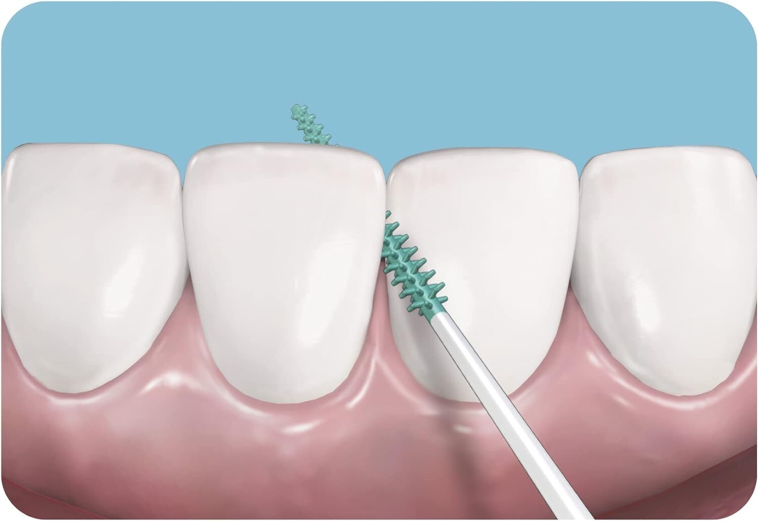 Powerful Dental Picks – Plaque Removal, Gingivitis Prevention – 320 Count