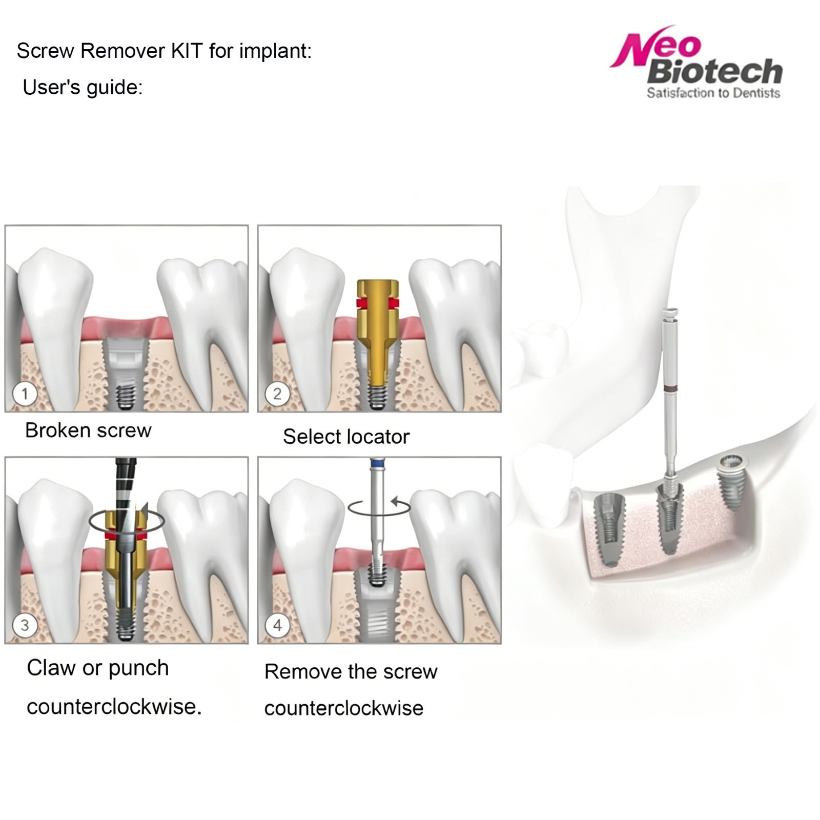 Hiossen Implant Multi Abutment Machine Driver Dental Surgical Tool Osstem