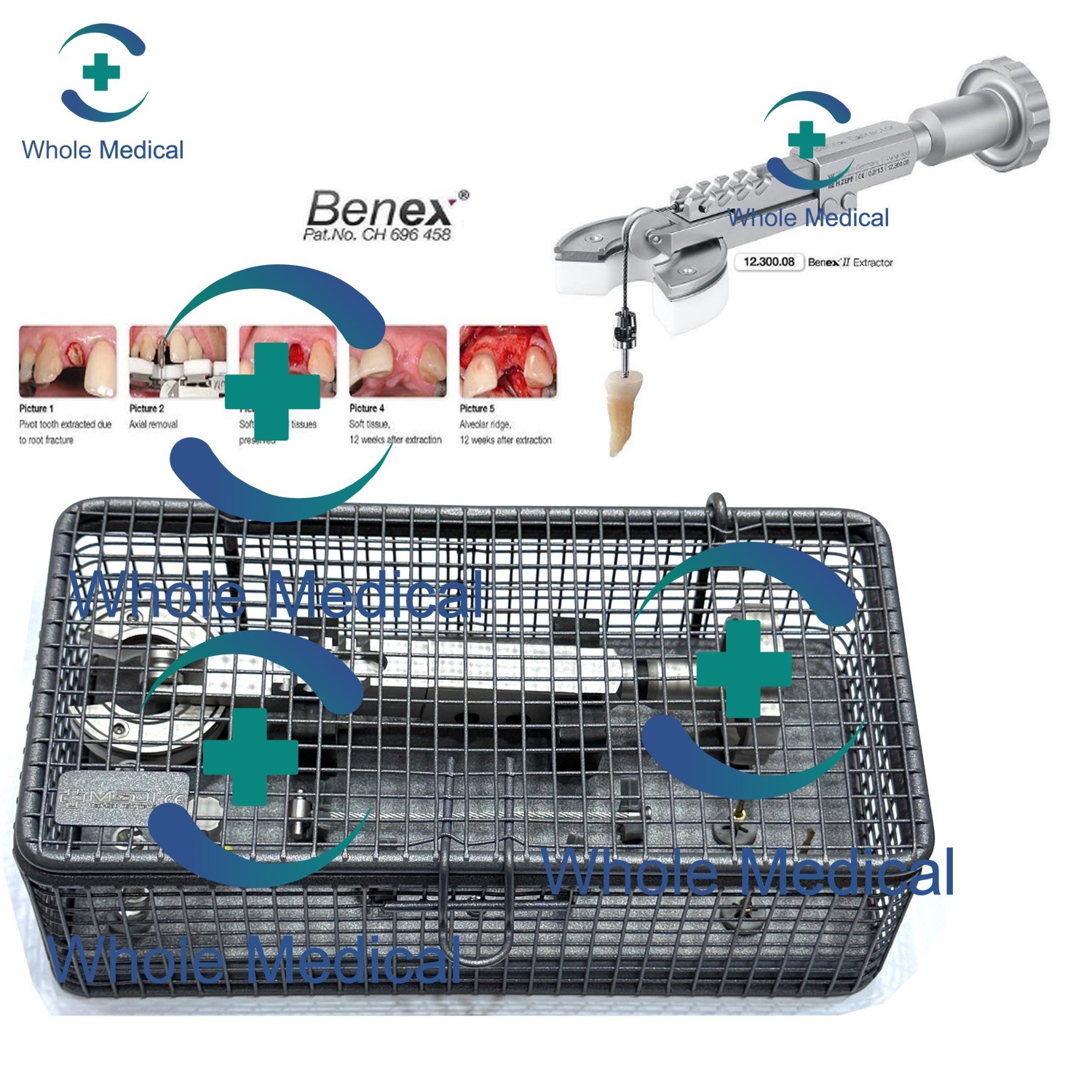 BENEX II Tooth Extraction System Root Extractor Instrument Kit Dental Surgical