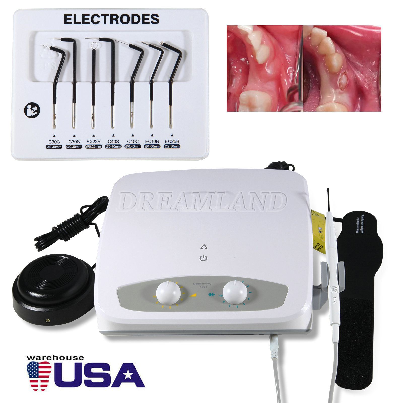 Dental Electro Electrosurgery Unit Machine High Frequency Electric 7pcs Knife