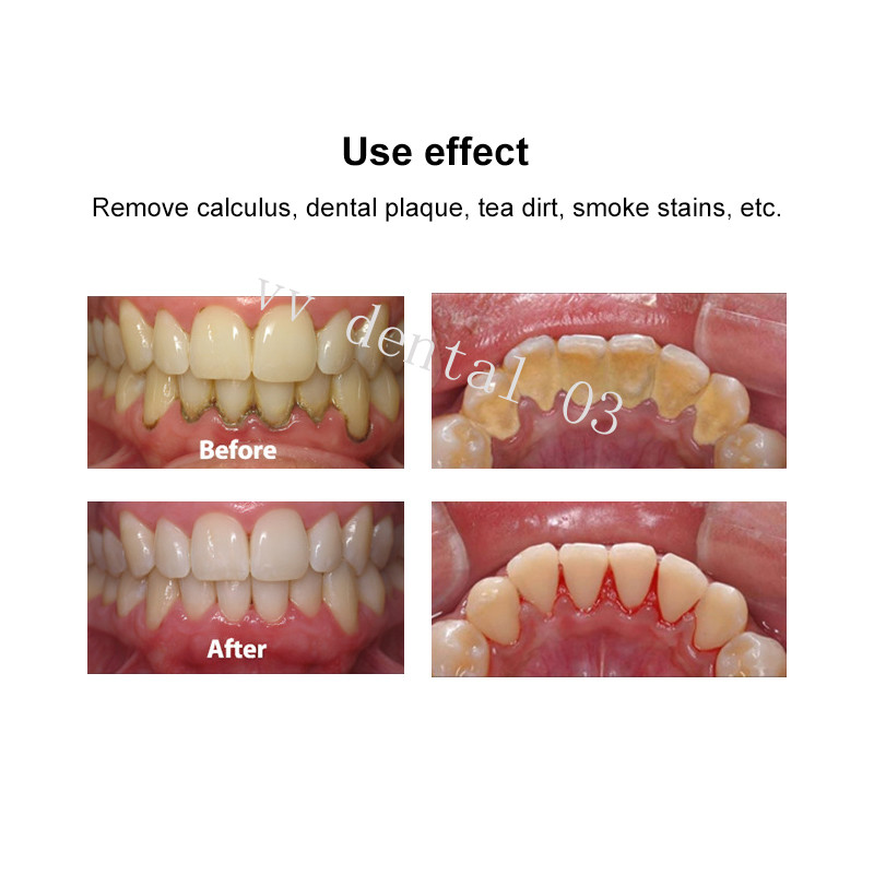 Dental Air Prophy Unit Teeh Whitening Spary Polisher Jet Air Flow Oral Hygiene