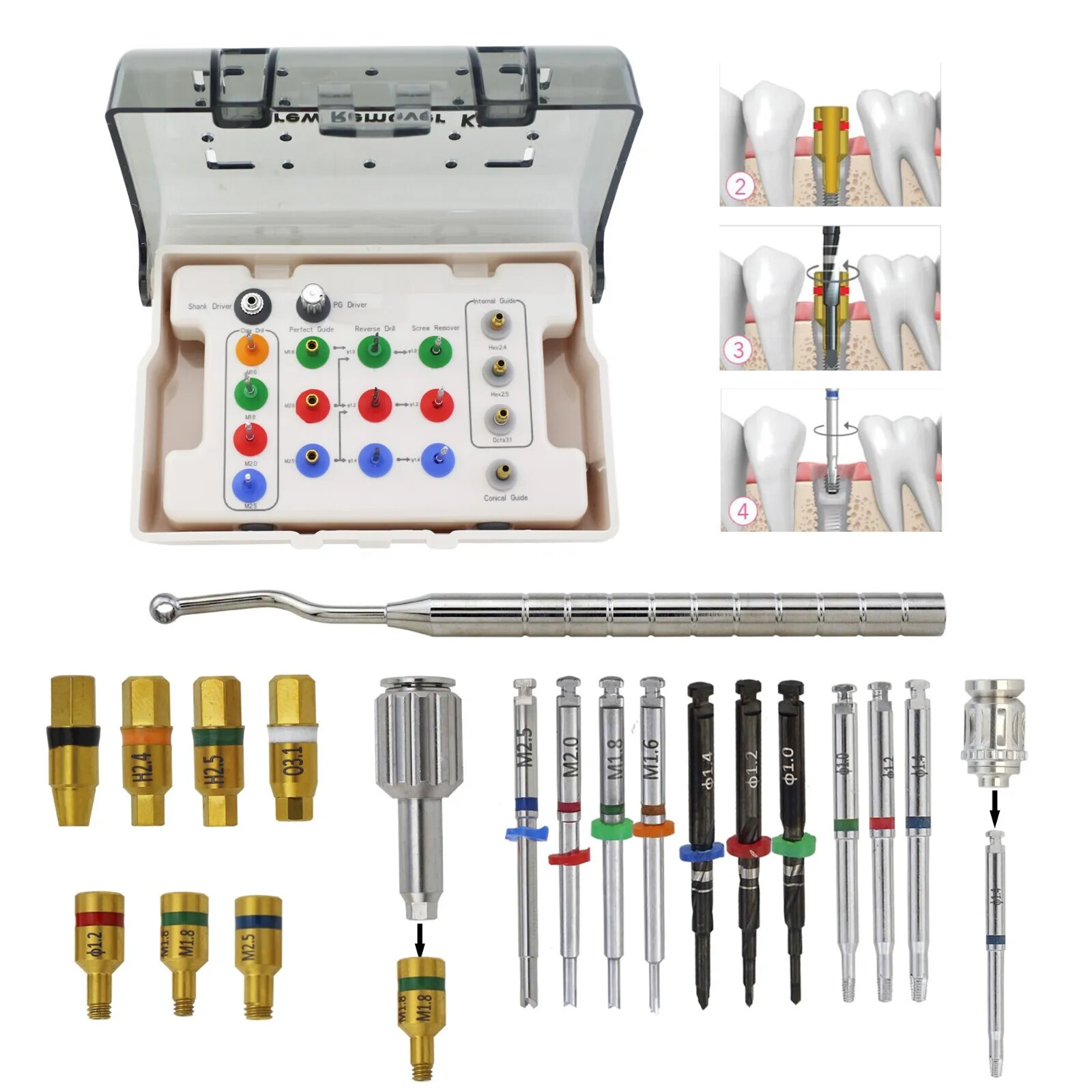 Implant NeoBiotech SR Broken Screw Removal Kit Remover Reverse Claw Drill Driver