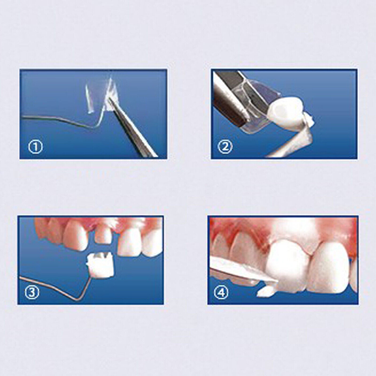 Dental Deciduous Transparent Preformed Crowns Anterior/Posterior/Full/ Matrices