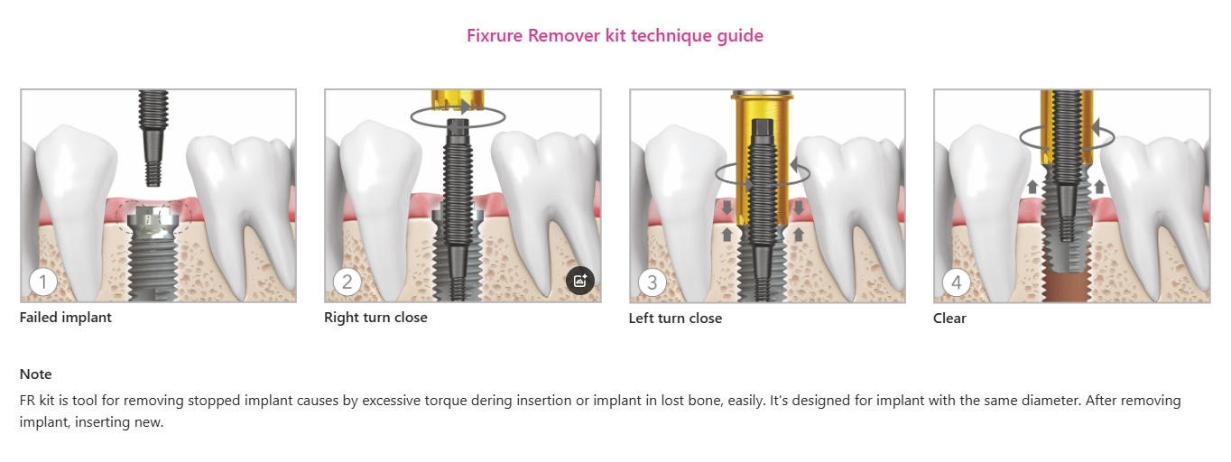 Neo FR Implant Fixture Removal Kit Dental Screw Hex Driver Neobiotech FR Wrench