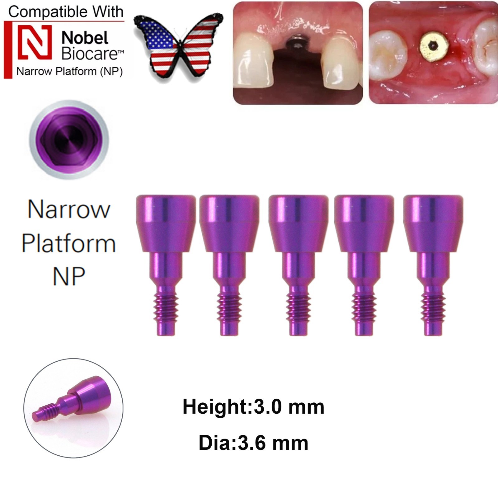 US 5Pcs Dental Healing Abutment NP RP Internal Conical Fit Nobel Biocare Implant