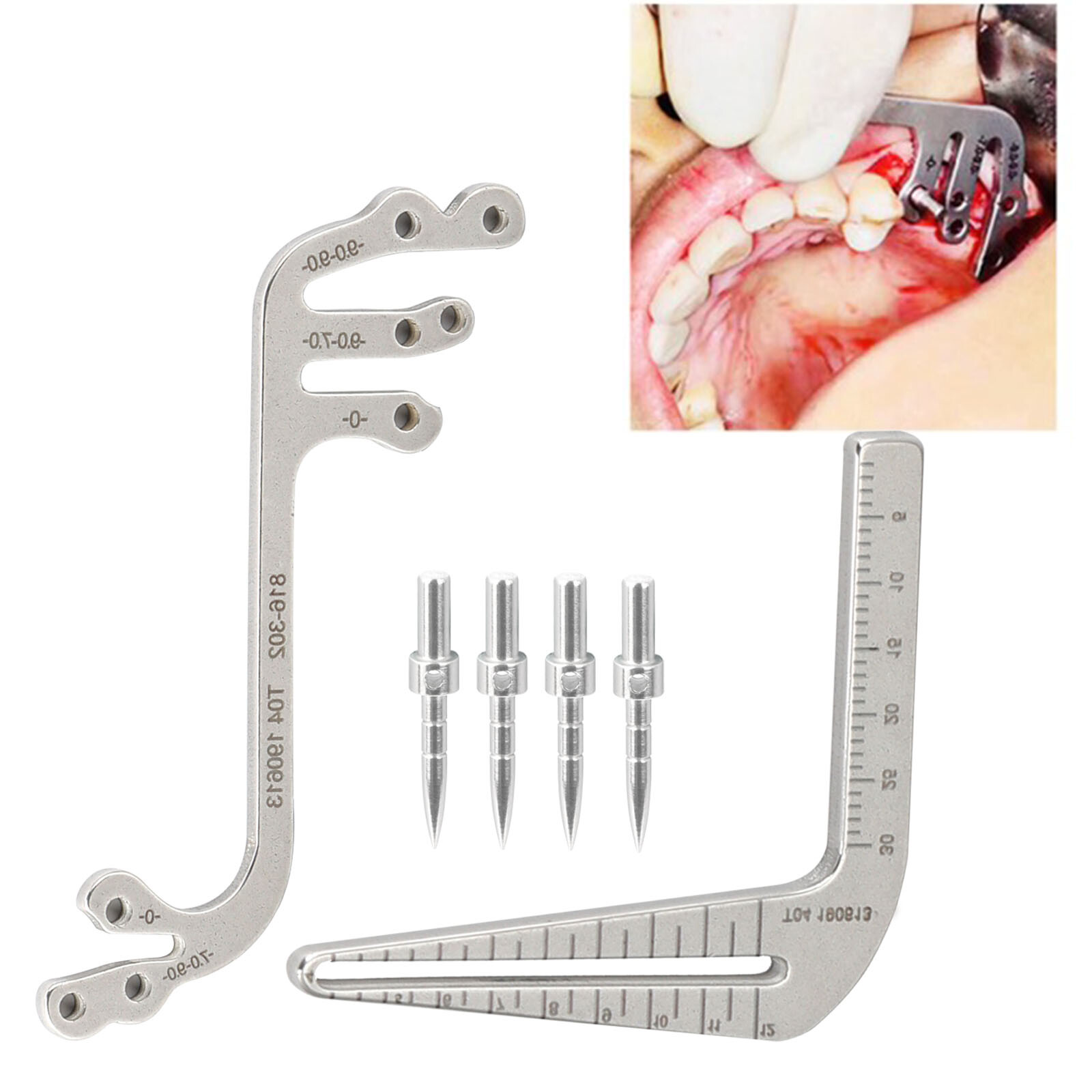 Dental Implant Guide Locator Set Measuring Ruler Calipers/Implant Locating Guide