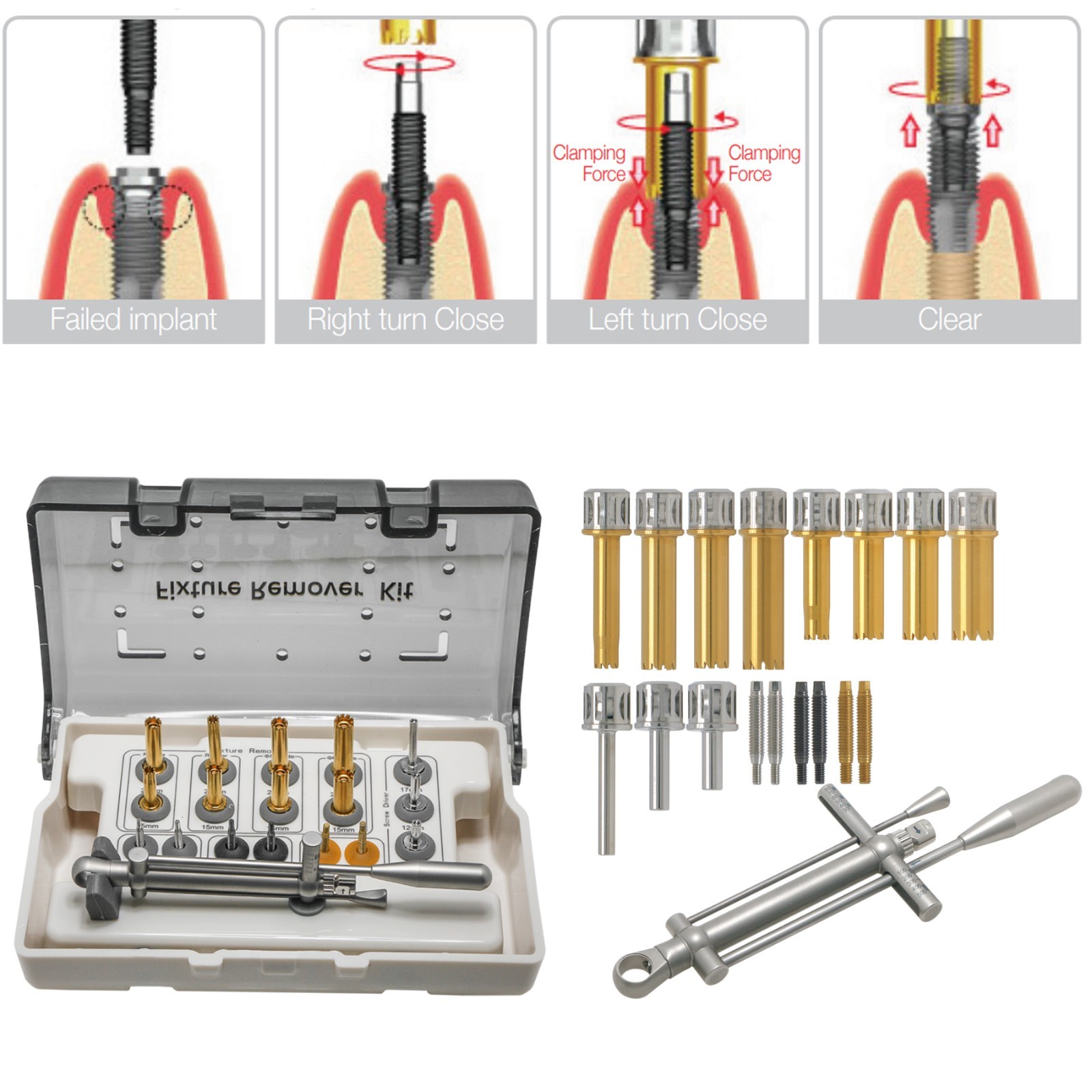 Neo FR KIT Implant Fixture Remover Screw Hex Driver Neobiotech Wrench Universal