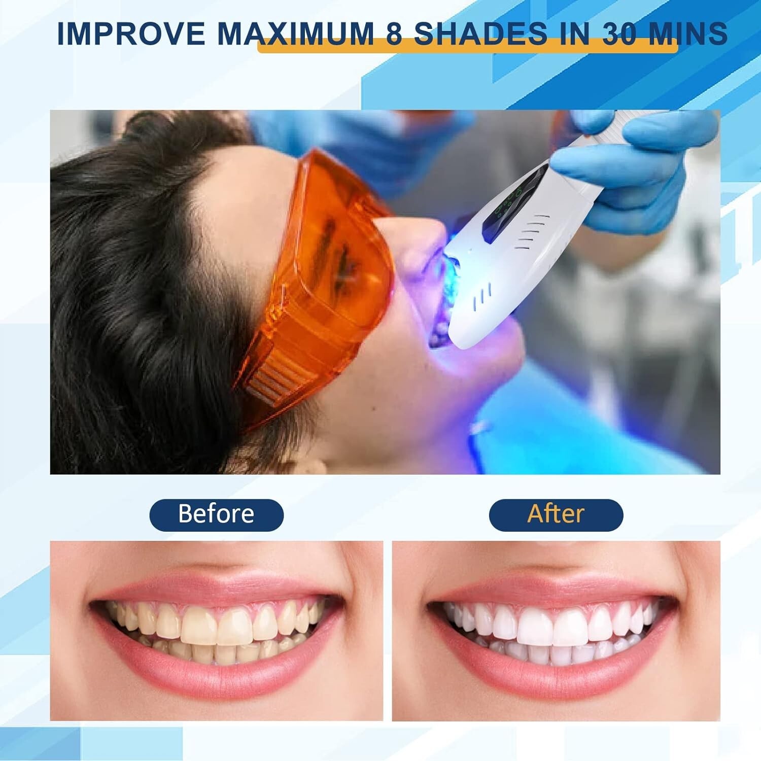 Teeth Whitening Lamp – Professional Teeth Whitening Machine W/Adjustable Stand