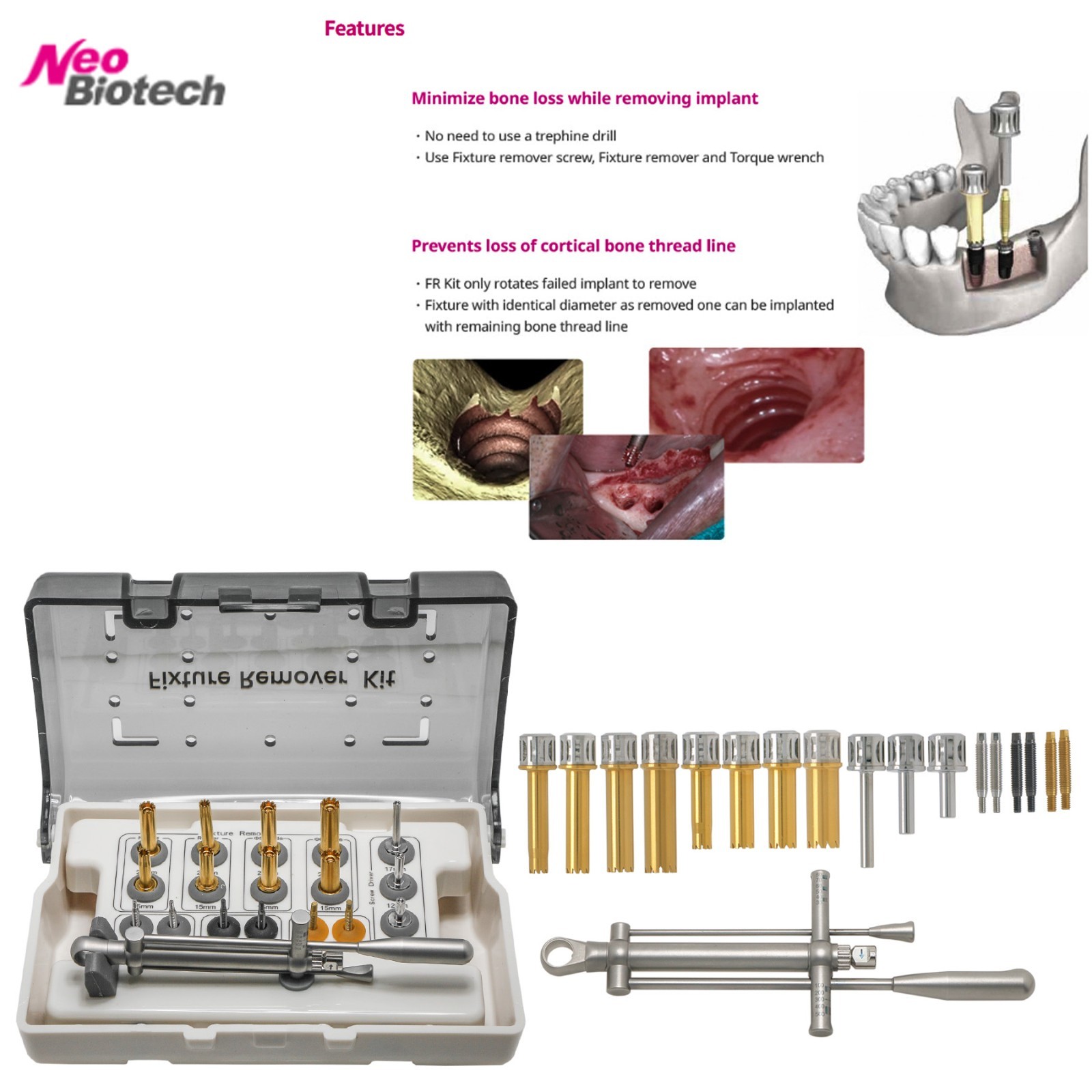 NeoBiotech FR Implant Fixture Remover Kit Compatible with Internal Hex Tools New