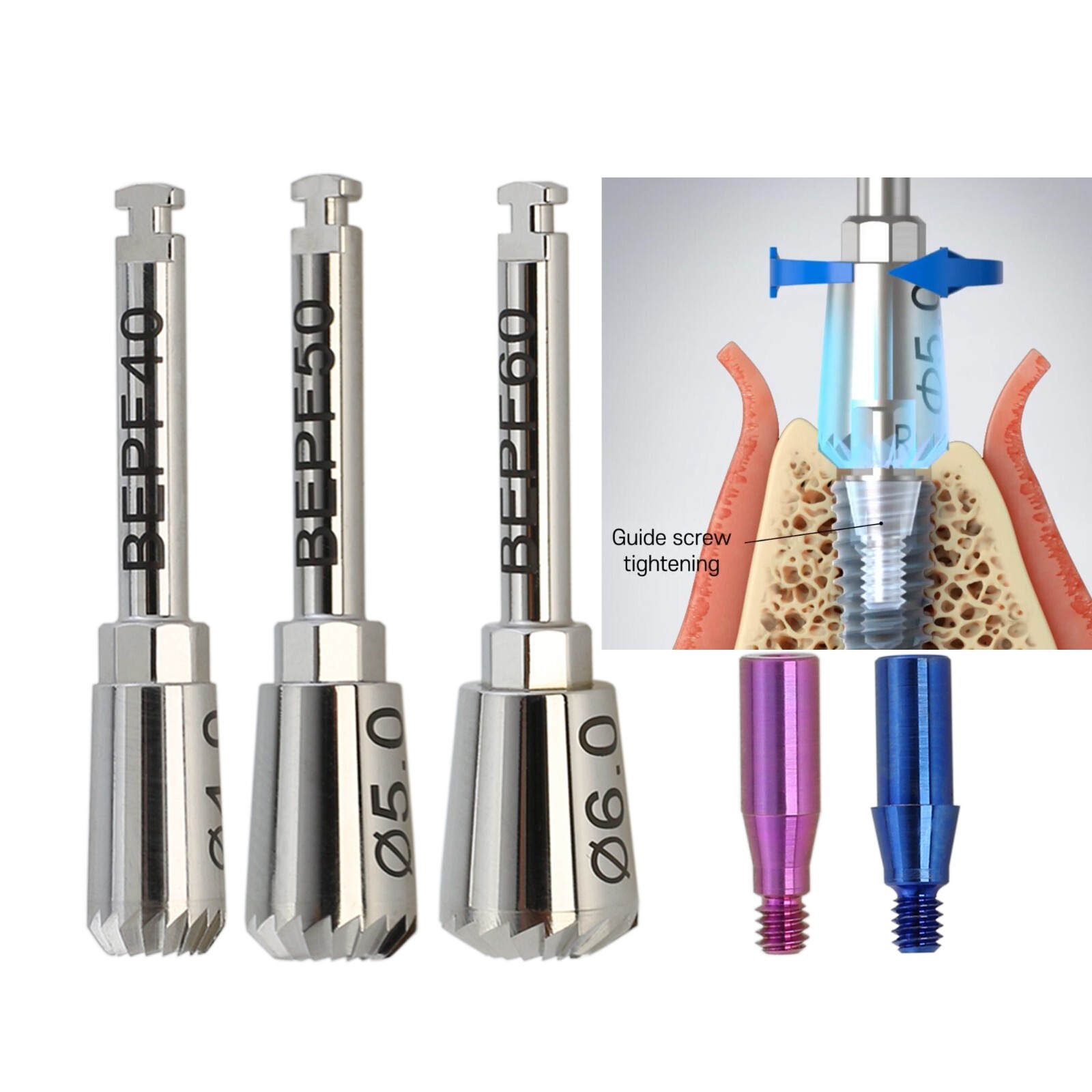 Hiossen Implant ET Bone Profiler Surgical Guide Screw Kit ABT 4.0 5.0 6.0 OSSTEM
