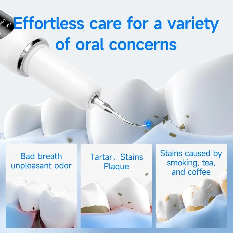 Ultrasonic Plaque & Tartar Remover for Teeth – Rechargeable Dental Scaler