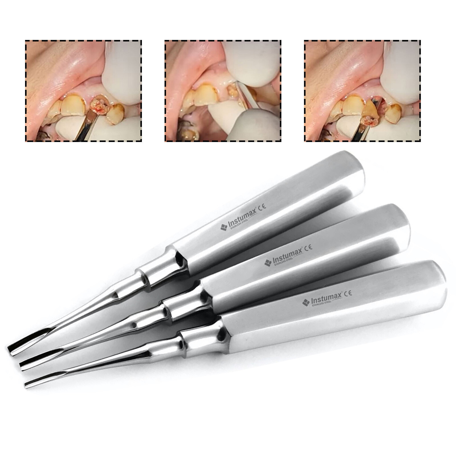 Dental Extracting Forceps Tooth Extraction Elevators Surgical Wisdom Tooth