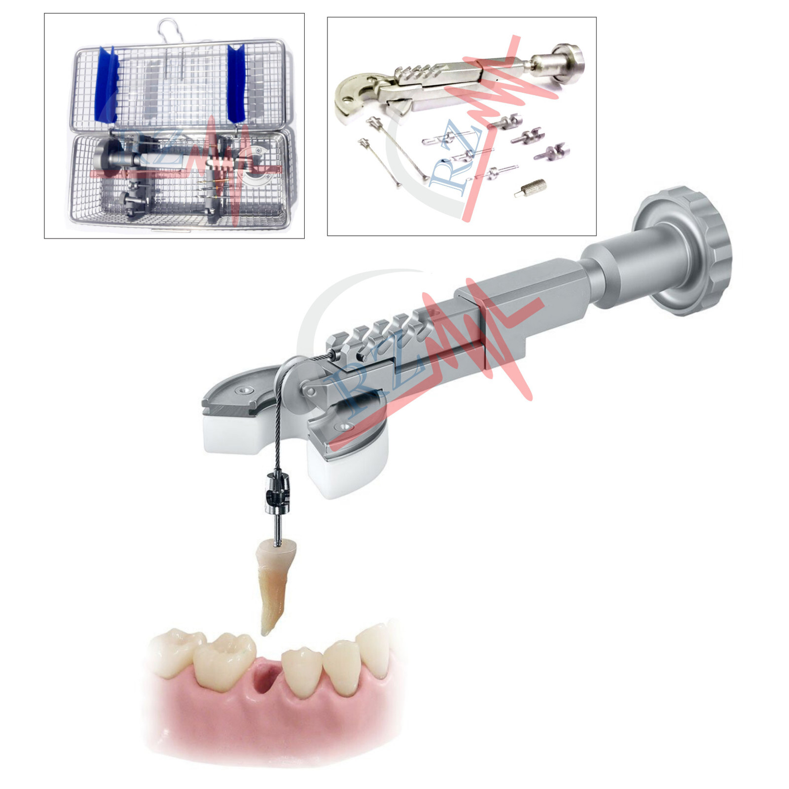BENEX II TOOTH EXTRACTION SYSTEM COMPLETE SET FOR DENTAL PRACTICES HIGH QUALITY
