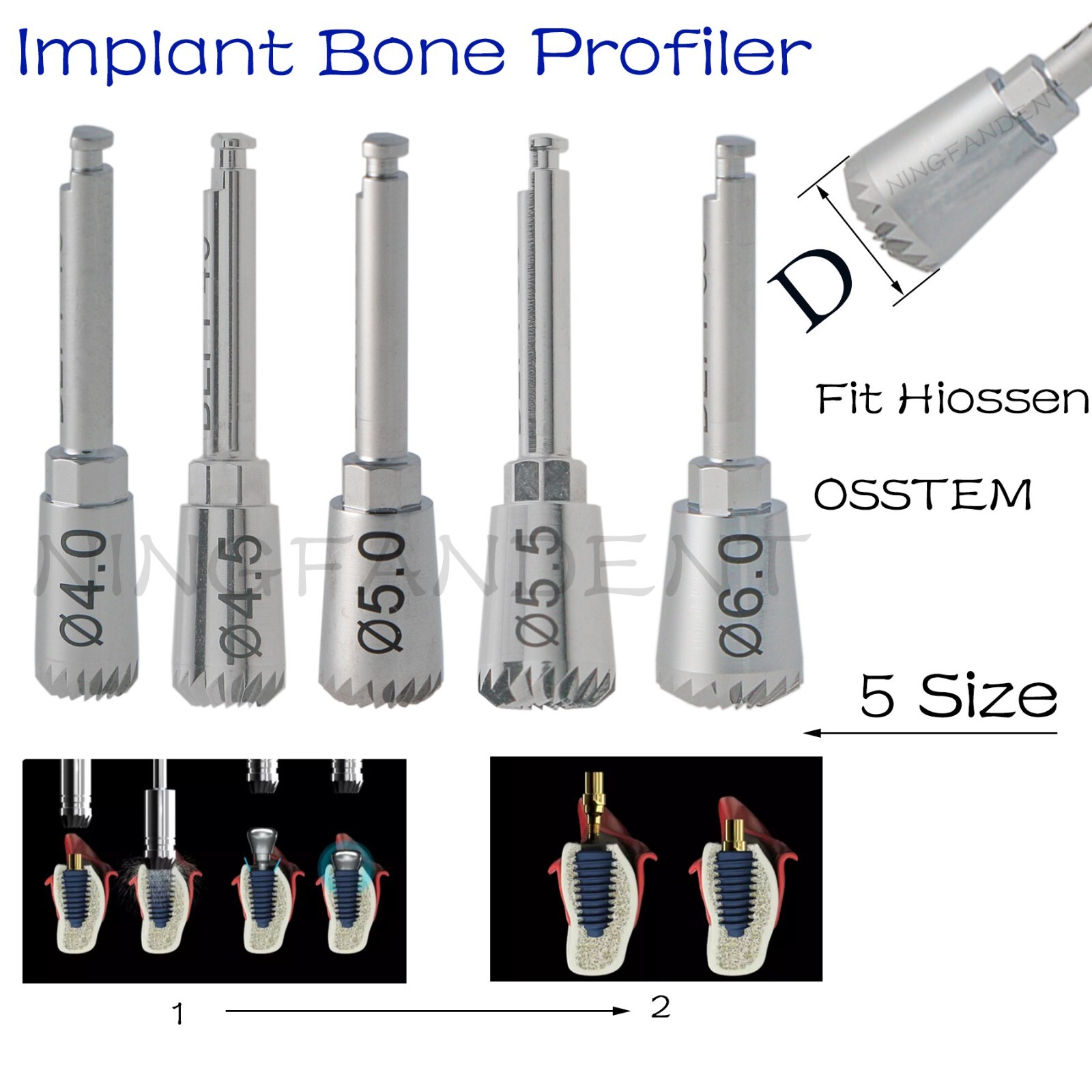 Universal Hiossen Adin Zimmer Mis Implant System Bone Profiler &Guide Screw Kit