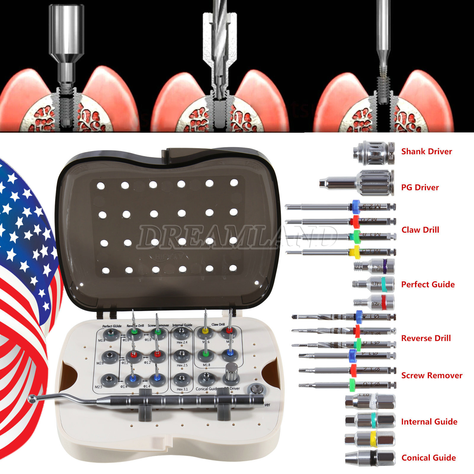 Dental Implant Broken Screw Removal Kits Surgical Tool Instrument NeoBiotech UPS