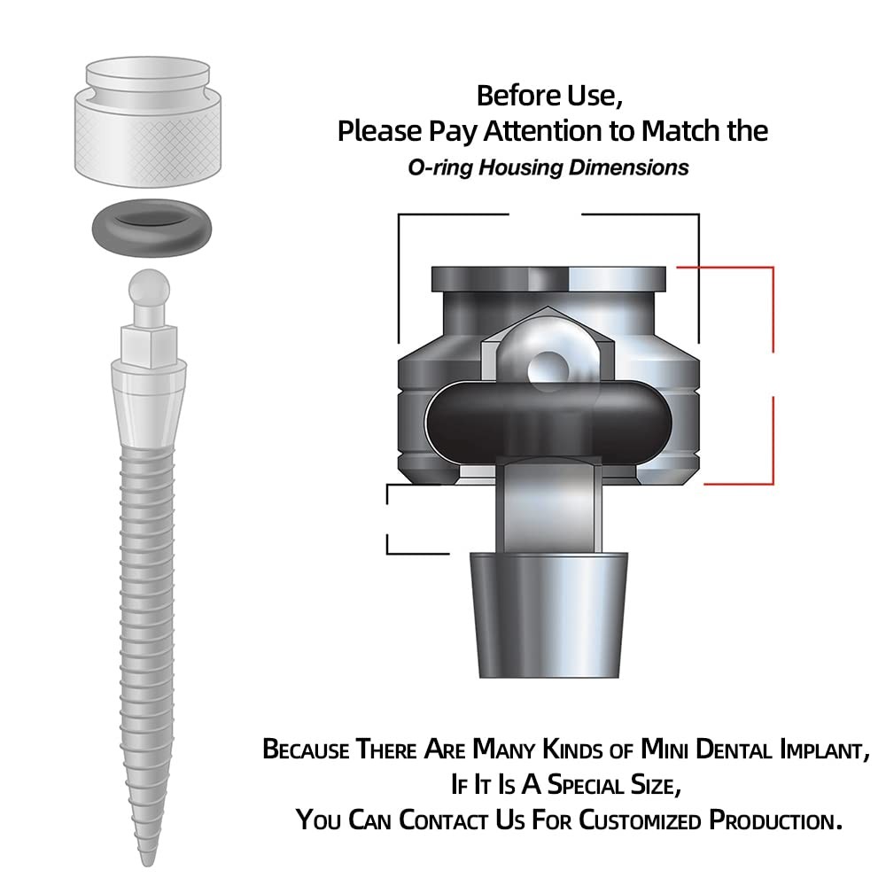 O-Ring, Buna-n, Tool Kit with 3 Convenient Sizes, Replacement for Mini Dental Im