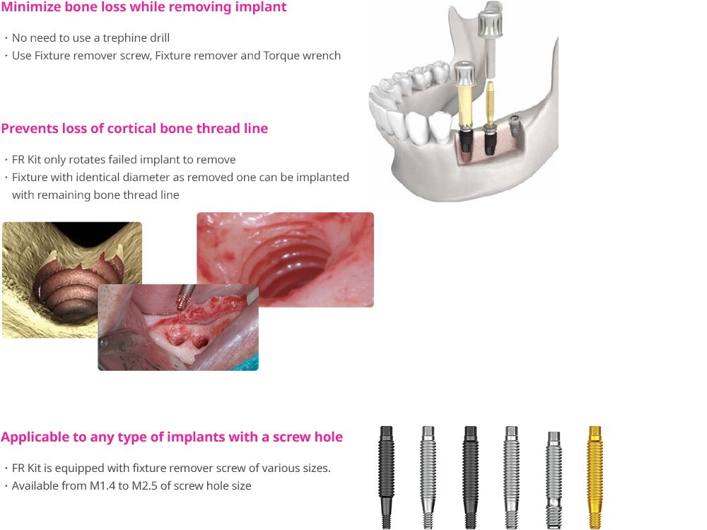 Neobiotech FR Implant Fixture Remover Kit Removal Dental Screw Hex Driver Wrench