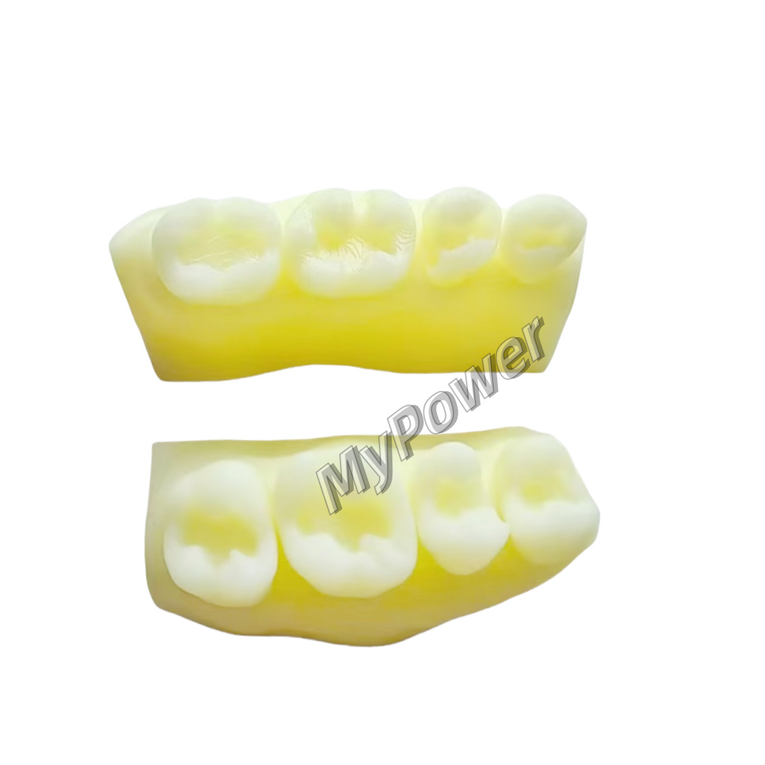 3Sets Dental Caries Decay Teeth Model Composite Restore Template Anterior Molar