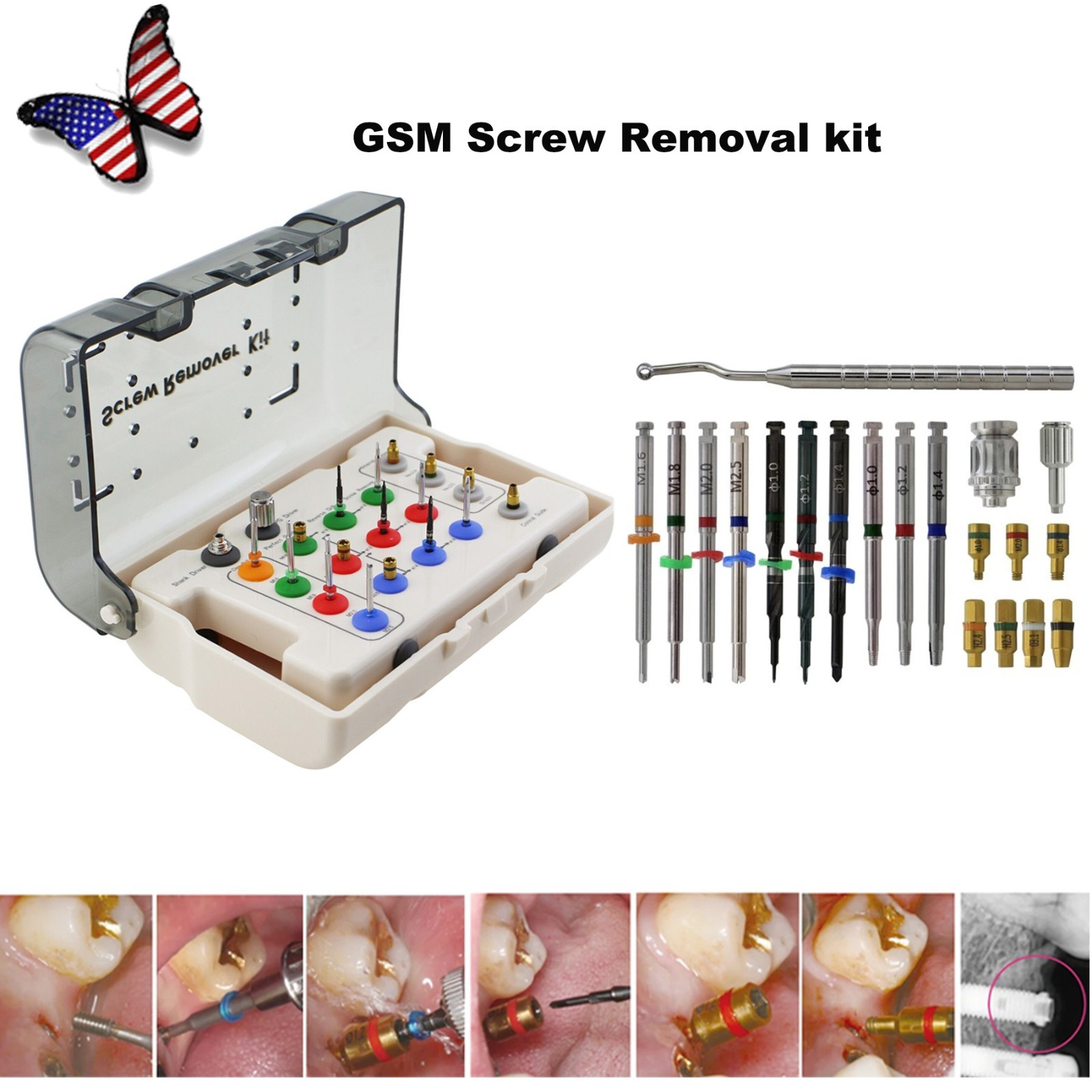 Universal Broken Screw Remover Kit Instrument NeoBiotech Surgical Implant Tool