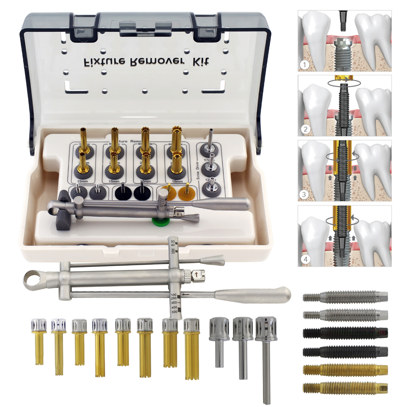 Neobiotech FR Implant Fixture Remover Kit Removal Dental Screw Hex Driver Wrench