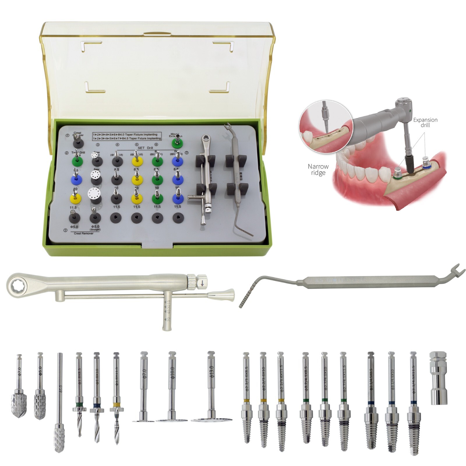 Implant ESSET Kit Easy Split Expansion of the Narrow Ridge Fits HIOSSEN OSSTEM